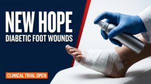 diabetic foot ulcer investigational spray