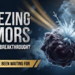 MRI-Guided Cryoablation: Australia’s Minimally Invasive Cancer Treatment Explained